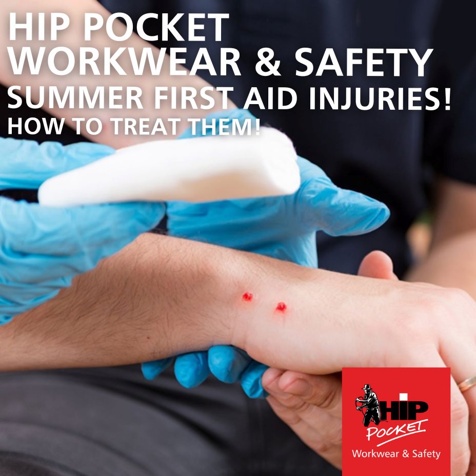 Top 3 Summer First Aid Injuries and how to treat them!